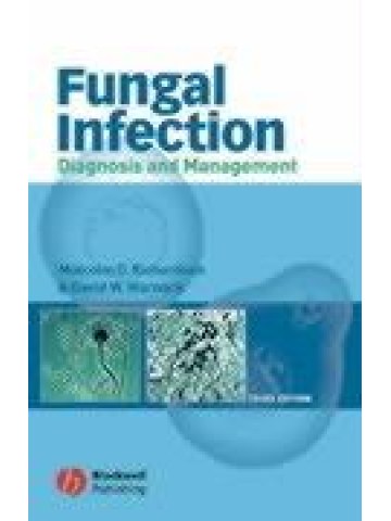 Fungal Infection: Diagnosis and Management Fungal Infection: Diagnosis and Management