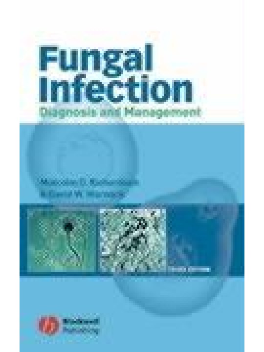 Fungal Infection: Diagnosis and Management