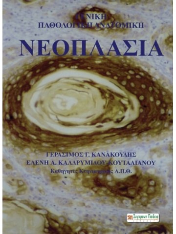 Νεοπλασία Νεοπλασία