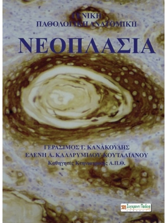 Νεοπλασία Νεοπλασία